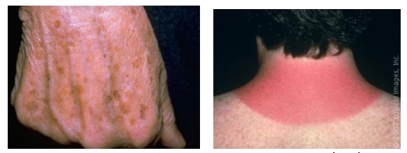 پرونده:نگهداری پوست از اشعه مضر آفتاب.jpg
